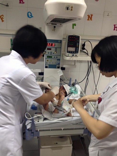 Bác sĩ ra chợ xin từ thiện cứu 2 bé song sinh dính liền: Bị trách nhưng vẫn vui - ảnh 3