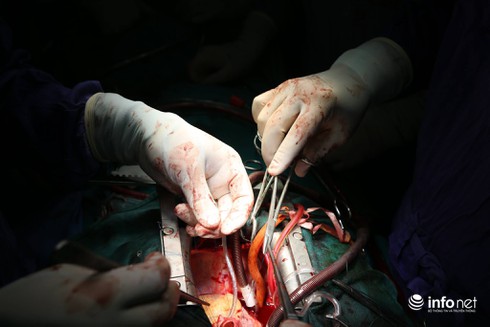 Vợ chiến sĩ cảnh sát biển được ghép tim vẫn chưa dám tin vào điều kì diệu - ảnh 1