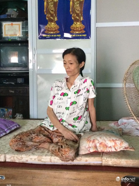 Lời khẩn cầu của bà mẹ bị ung thư vú mong cứu con bị suy thận - ảnh 1