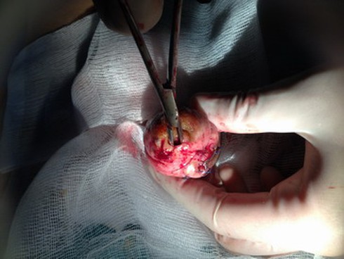 Thói quen này có thể mang đến ung thư cho con trai - ảnh 1