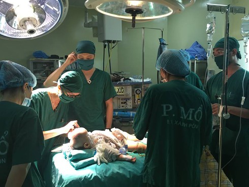 Phẫu thuật cho cháu bé dị dạng hộp sọ - ảnh 1