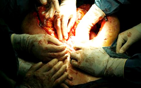 Trường hợp nào được coi là mua bán nội tạng? - ảnh 1