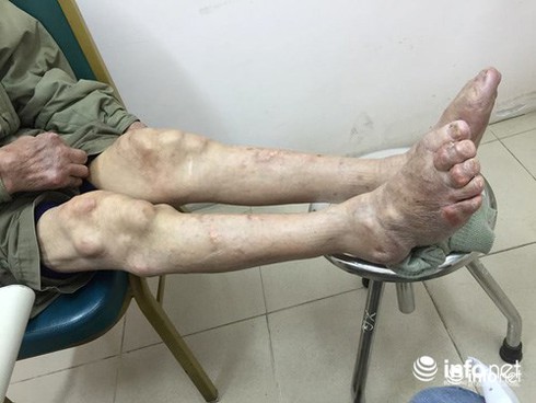 Giảm đau ngay sau khi uống