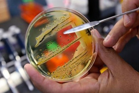 Cái chết của bé 17 ngày tuổi và nỗi lo của toàn cầu - ảnh 1