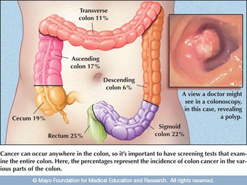 Bác sĩ Bệnh viện K chỉ ra “chìa khóa vàng” để chữa ung thư đại trực tràng - ảnh 2