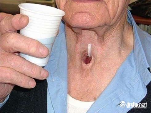 Thủ phạm êm ái gây ung thư xuất hiện hằng ngày - ảnh 1