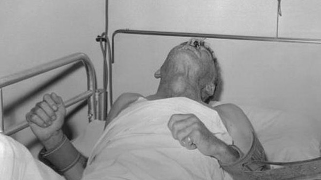 Kém hiểu biết, ông bố trẻ mắc căn bệnh khiến bác sĩ bó tay