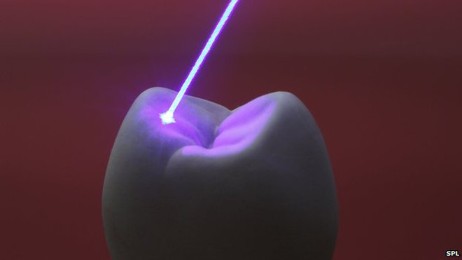 Điều trị bệnh răng miệng, ngủ ngáy bằng tia laser thế hệ mới