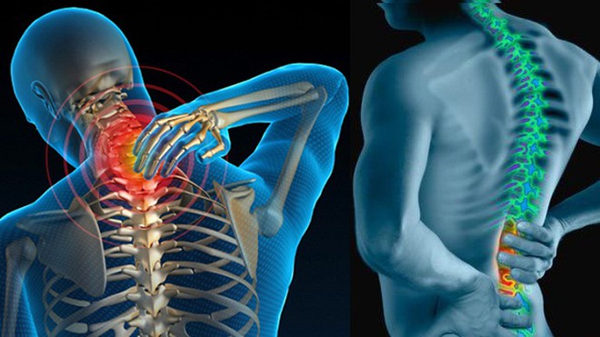 Đau mỏi vai gáy: Những cách xử lý kịp thời