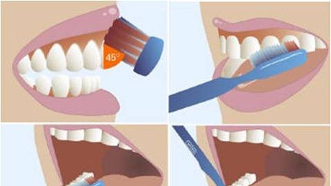 5 thói quen ảnh hưởng xấu tới răng miệng