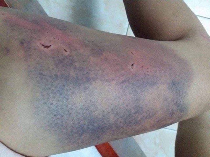 Cô gái “tố” bị bạn trai ghen tuông hành hung dã man - ảnh 1