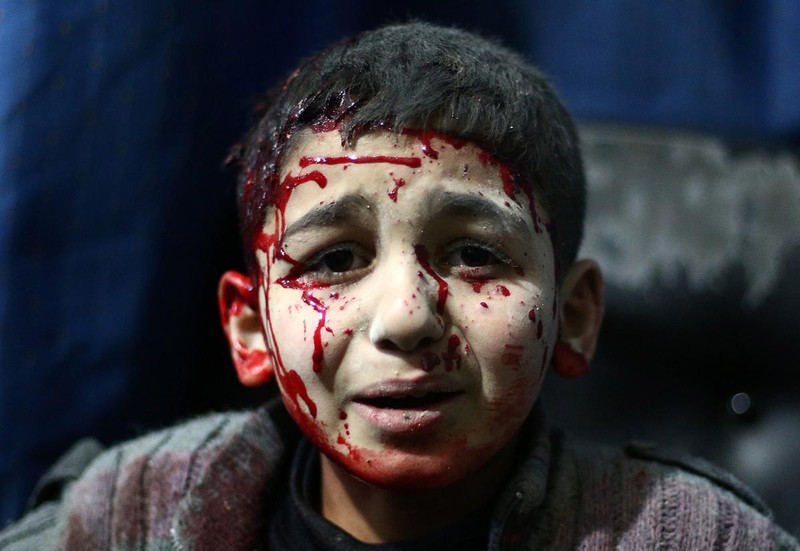 Cuộc sống đau thương của những đứa trẻ Syria giữa tâm điểm chiến sự - ảnh 18