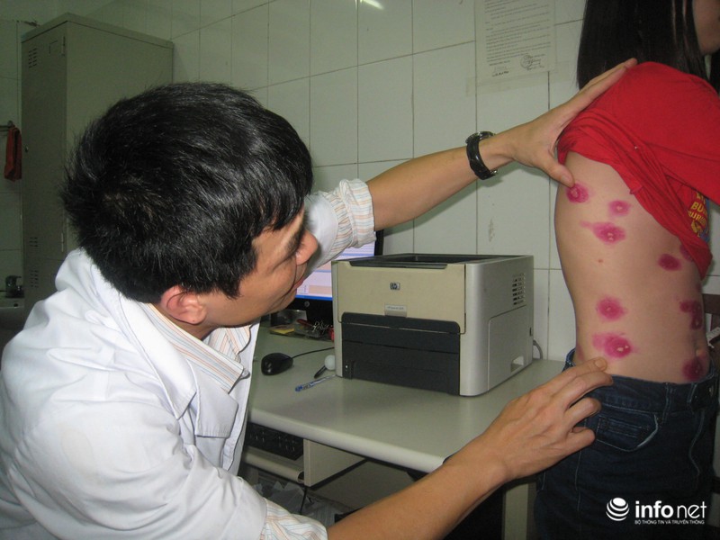 Toàn thân mưng mủ vì nắng nóng - ảnh 1