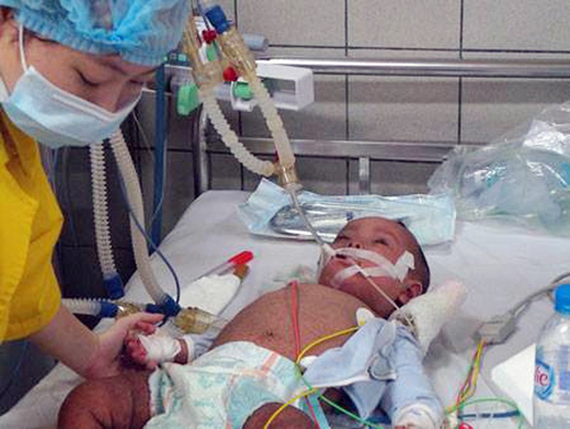 Kinh hoàng bệnh trẻ bú mẹ là chết - ảnh 1