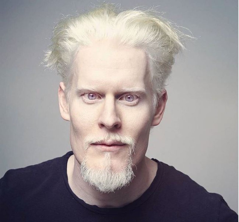 Ảnh: Vẻ cuốn hút của những người có màu da đặc biệt - ảnh 3