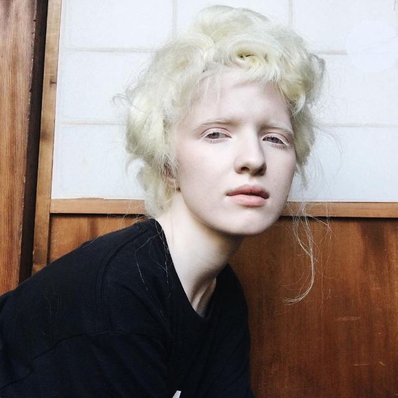 Ảnh: Vẻ cuốn hút của những người có màu da đặc biệt - ảnh 7