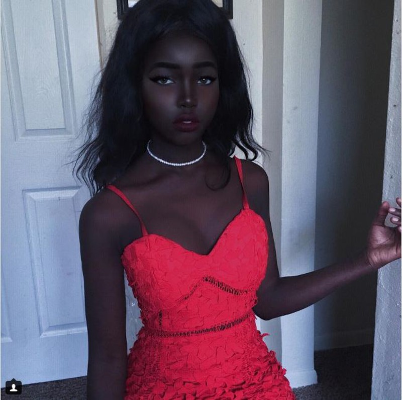 Ảnh: Vẻ cuốn hút của những người có màu da đặc biệt - ảnh 8