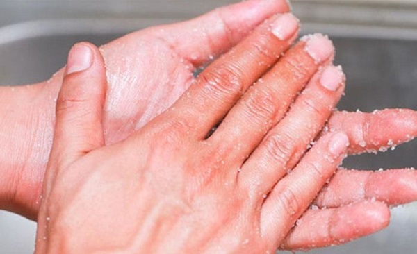 Meo tay vet keo 502 dinh tren da 2 Giadinhvietnam