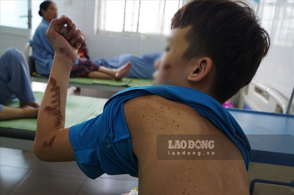 4 giờ tháo chạy khỏi 