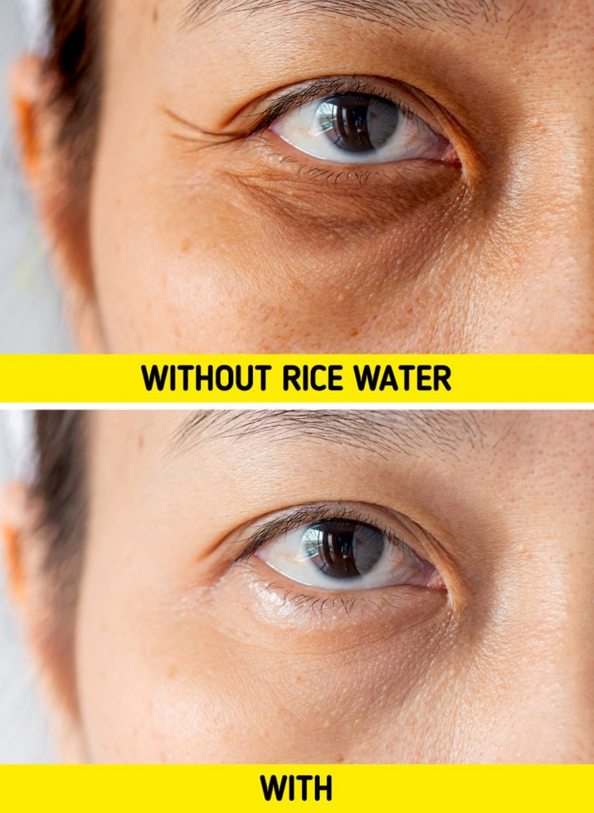 Sử dụng nước gạo trong quá trình chăm sóc da sẽ làm giảm quá trình lão hoá. 