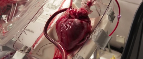 Thiết bị mới giúp hồi sinh tim đã ngừng đập - 1