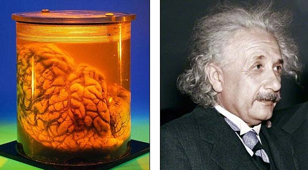 Người não to không thông minh hơn - 1