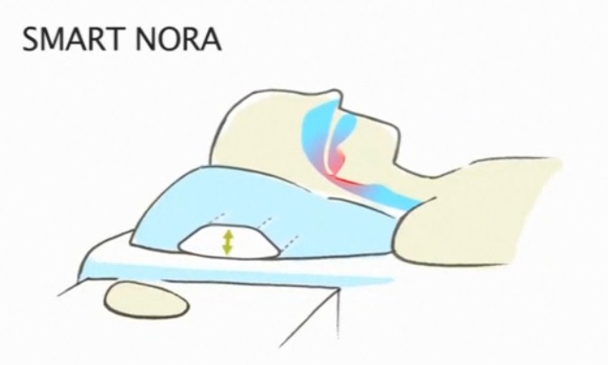 Thiết bị không dây giúp ngừng ngáy ngủ - 5