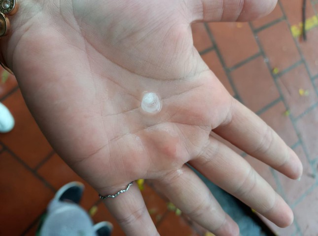 TPHCM bất ngờ xuất hiện mưa đá, dông mạnh ảnh 1