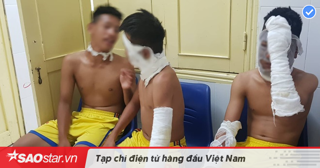 Nghe VietNamNet: Nổ chùm bóng bay, 3 cầu thủ Sông Lam Nghệ An bị bỏng nặng