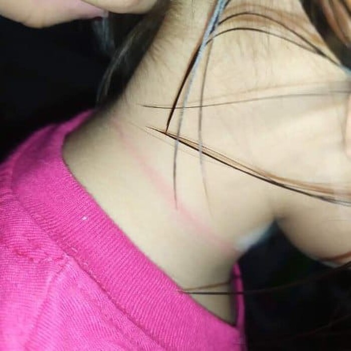 Bé gái 4 tuổi suýt mất mạng khi cố thực hiện thử thách treo cổ trên TikTok Ảnh 3
