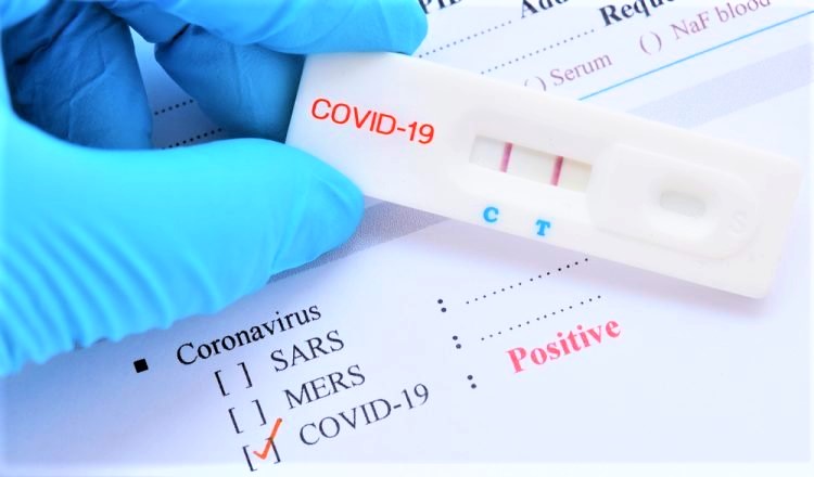 Chỉ mua sản phẩm kit test COVID-19 nằm trong danh mục Bộ Y tế cấp phép lưu hành - Ảnh 1.