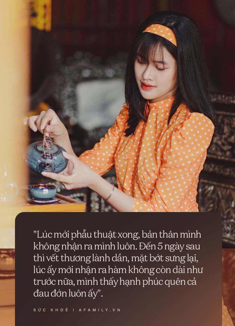 Màn lột xác “chấn động” của cô gái bị gọi là