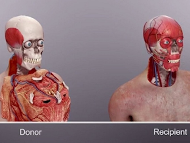 10 thành tựu y học nổi bật 2015, từ viagra cho nữ đến biến đổi gien di truyền