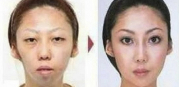 Bị chồng kiện 2,5 tỷ đồng vì phẫu thuật thẩm mỹ và... sinh con xấu xí