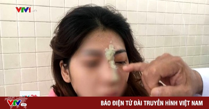 Nghe VietNamNet: Cô gái trẻ bị mù mắt sau tiêm filler nâng mũi tại spa