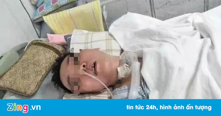 Người phụ nữ hôn mê 3 tháng chưa tỉnh sau khi nâng mũi