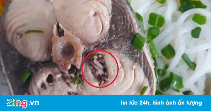 Mẫu thức ăn có sán của công nhân Đà Nẵng không còn để kiểm tra