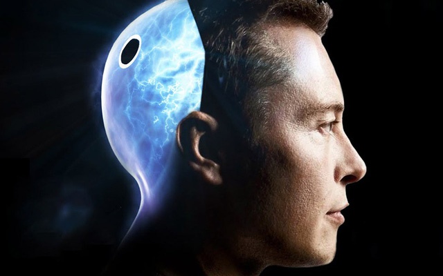 Elon Musk khoe chip đọc não người