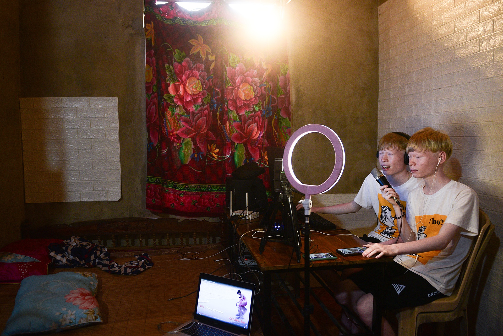 cap doi song sinh bach tang anh 9