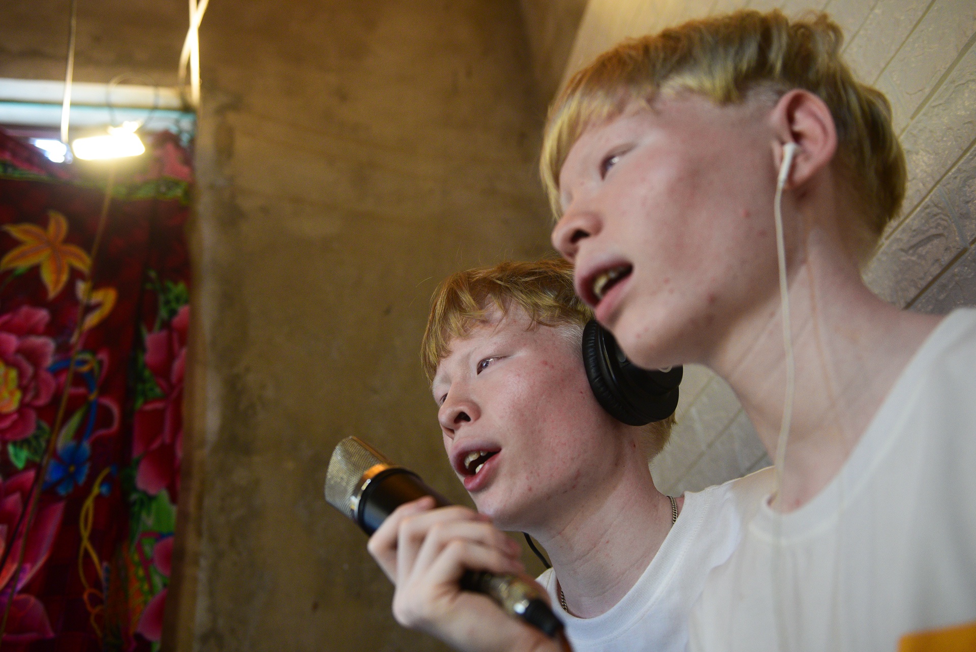 cap doi song sinh bach tang anh 11