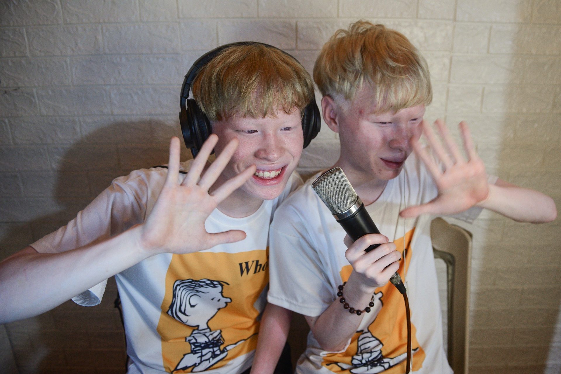 cap doi song sinh bach tang anh 12