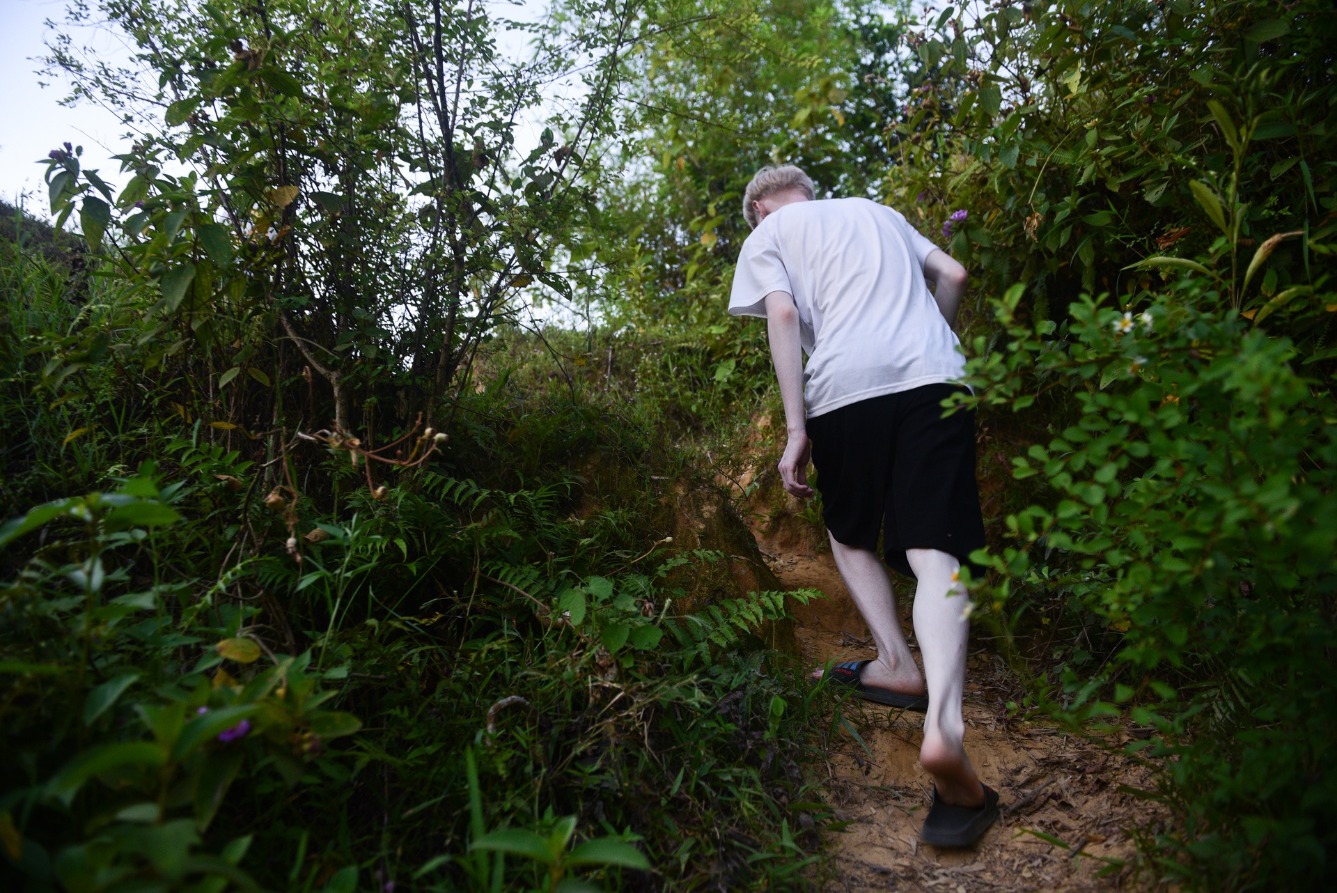 cap doi song sinh bach tang anh 18