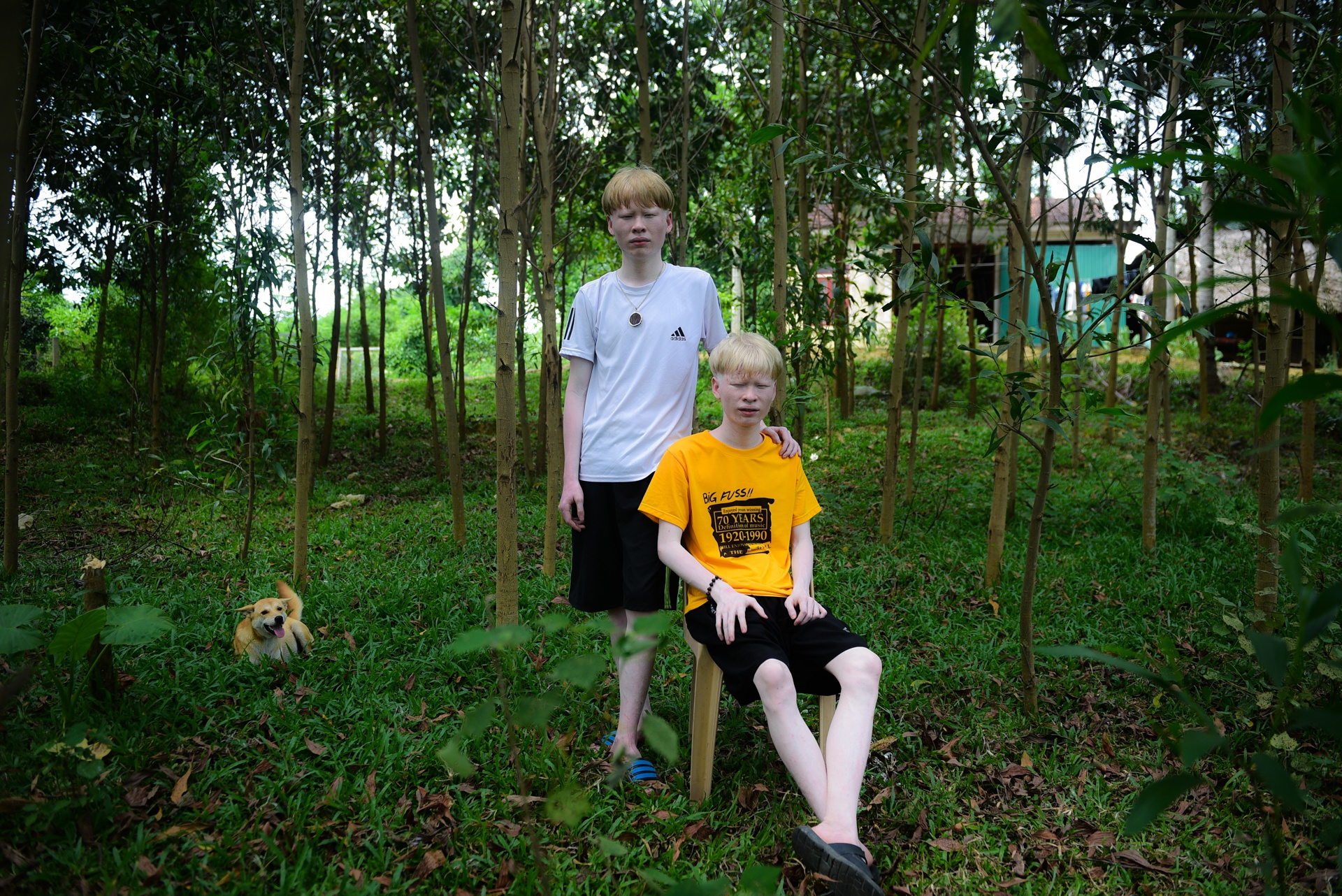 cap doi song sinh bach tang anh 1