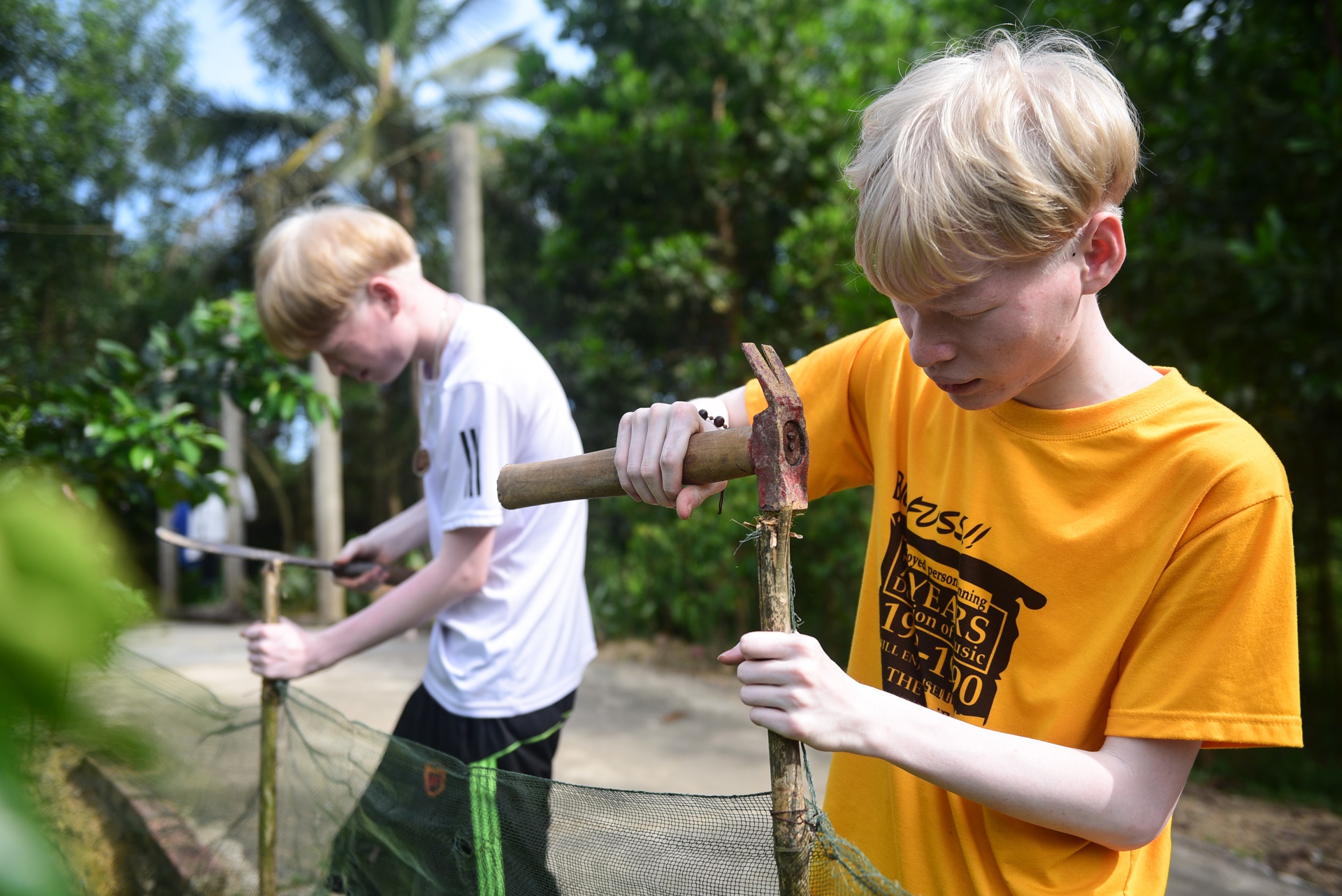 cap doi song sinh bach tang anh 2