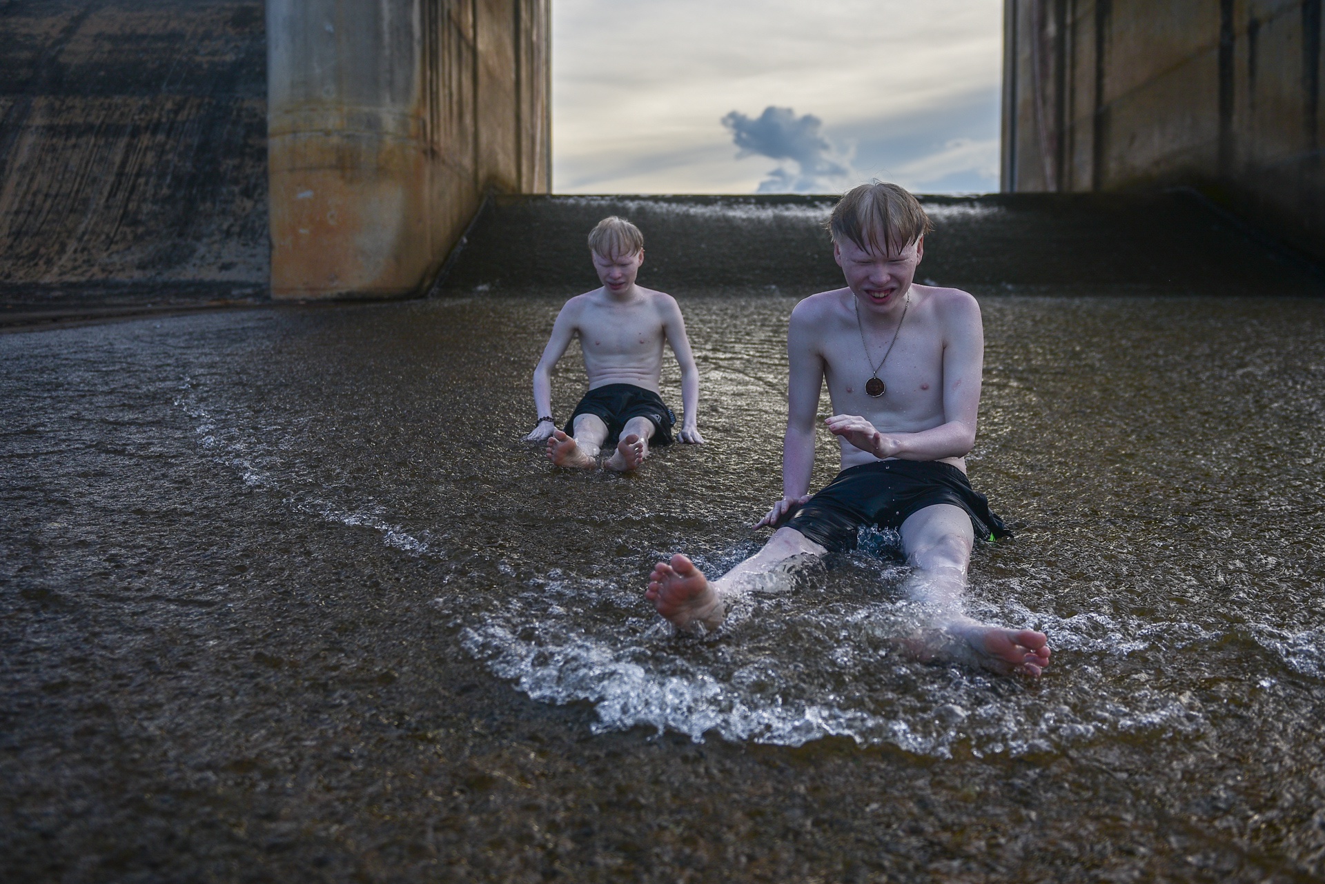 cap doi song sinh bach tang anh 21