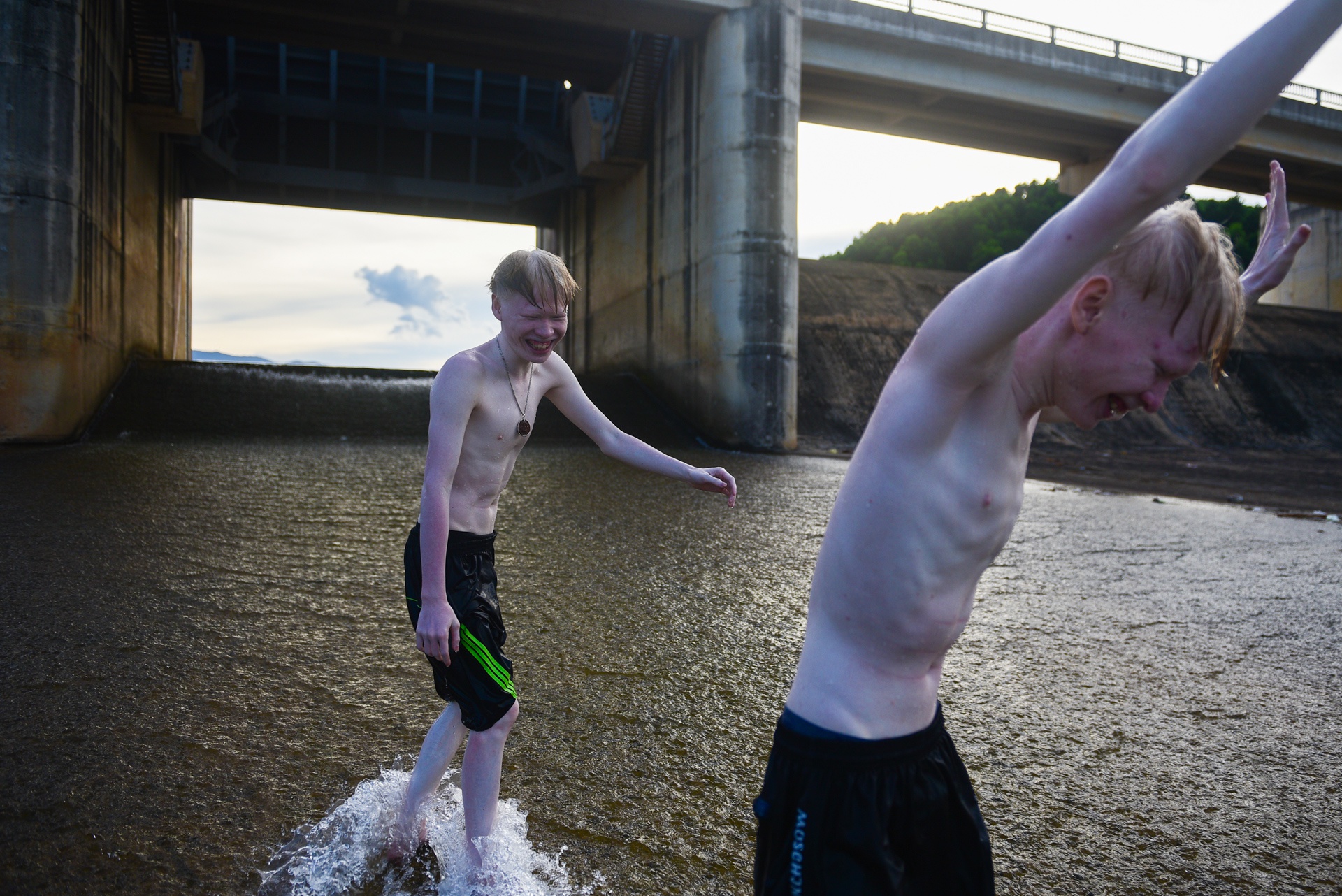 cap doi song sinh bach tang anh 20