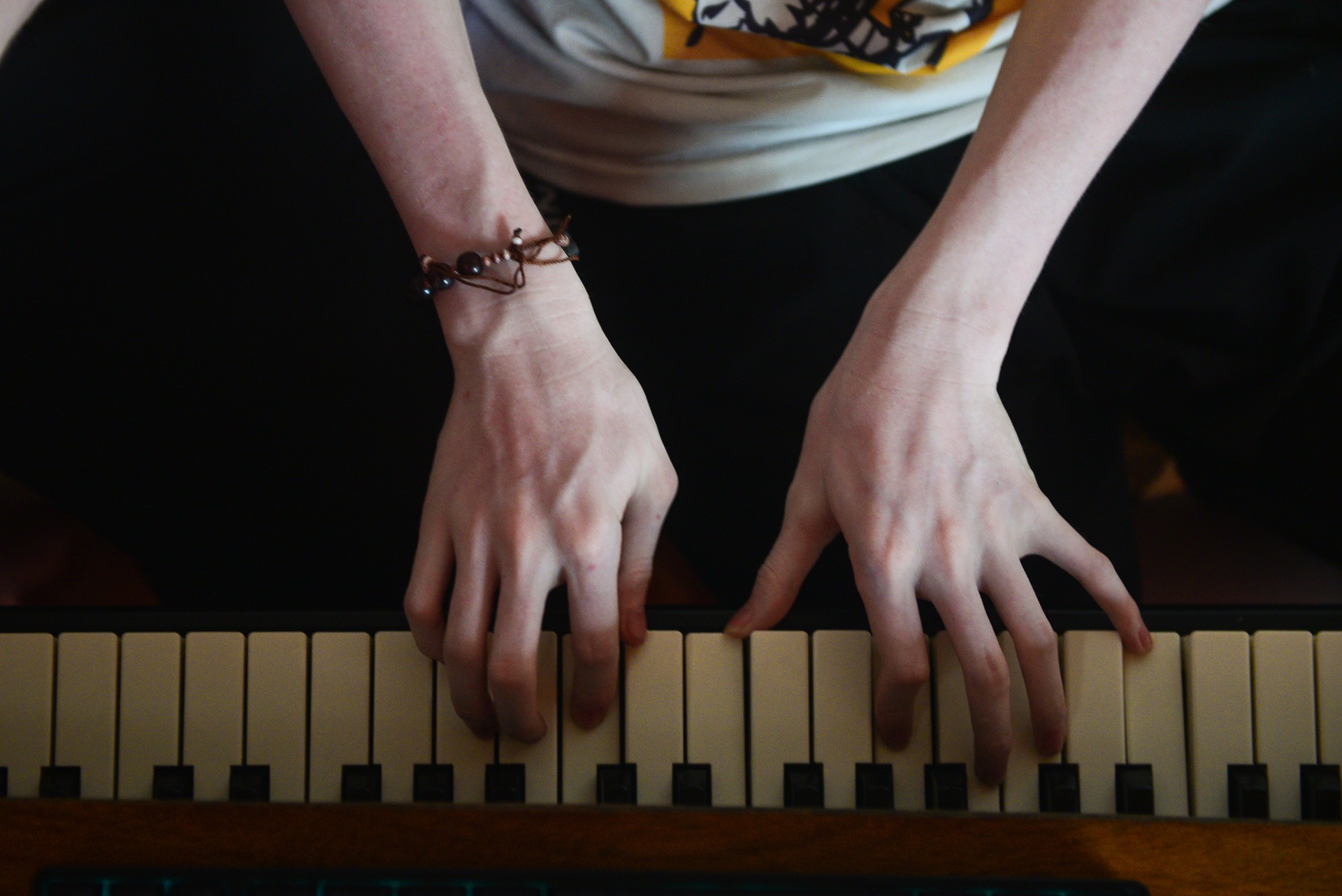 cap doi song sinh bach tang anh 13