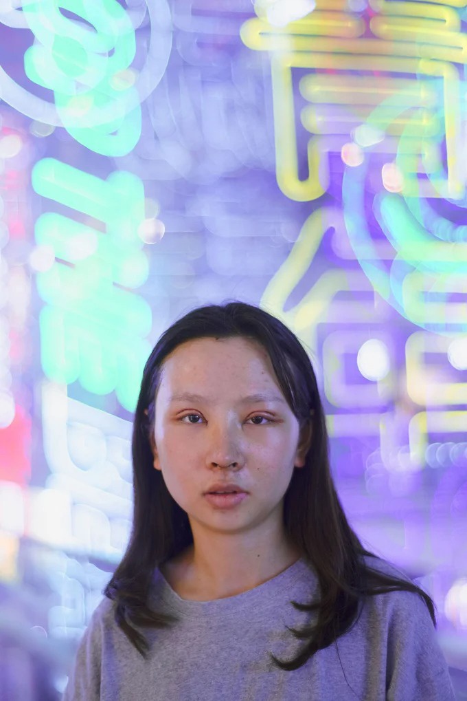 phau thuat tham my trung quoc anh 8