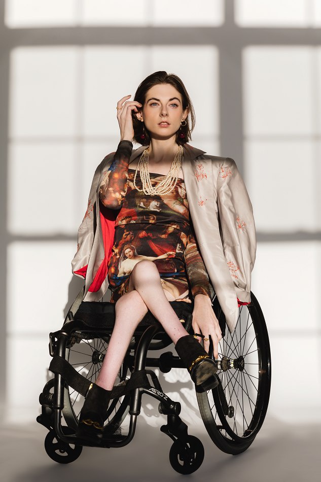 tình yêu của người mẫu khuyết tật ảnh 8 tinh yeu cua nguoi mau khuyet tat anh 8