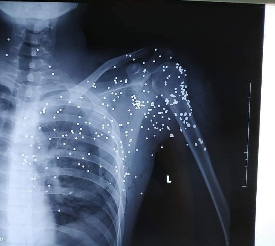 no sung tai Thai Binh anh 1